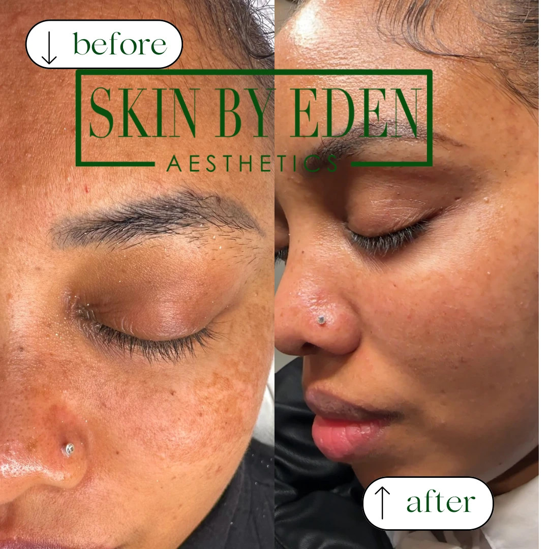 Original client before and after photographs, labelled before on the left and after on the right