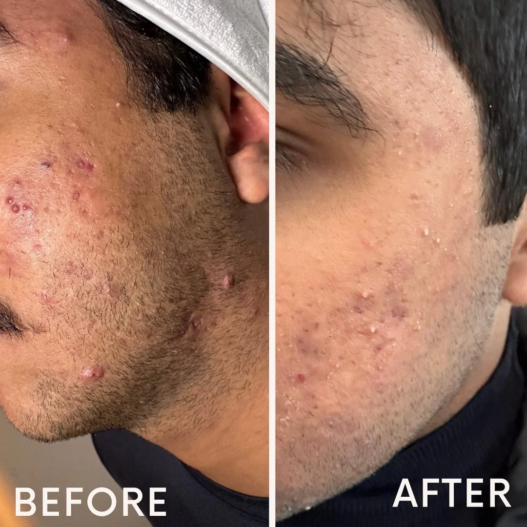 Original client before and after photographs, labelled before on the left and after on the right