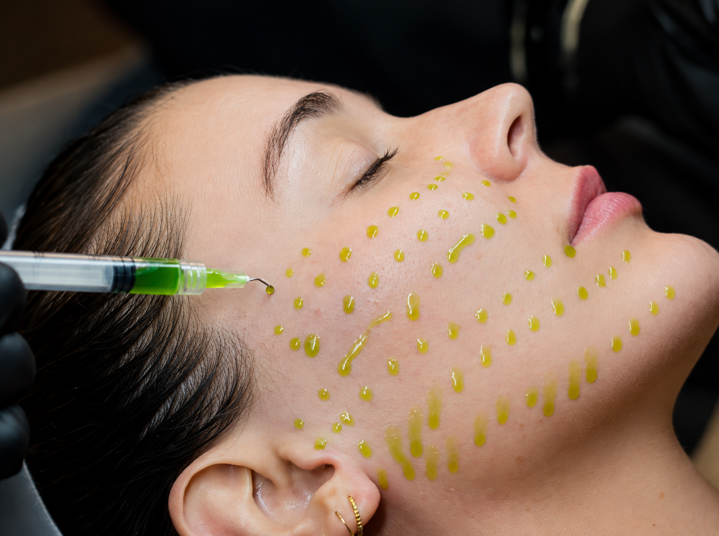 Illustrative image: A facial mask being applied by hand